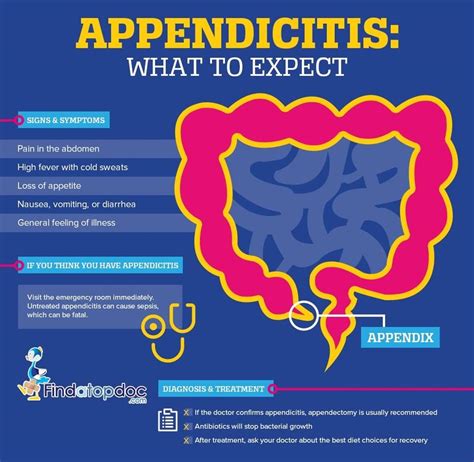 What are the benefits of not having an appendix?